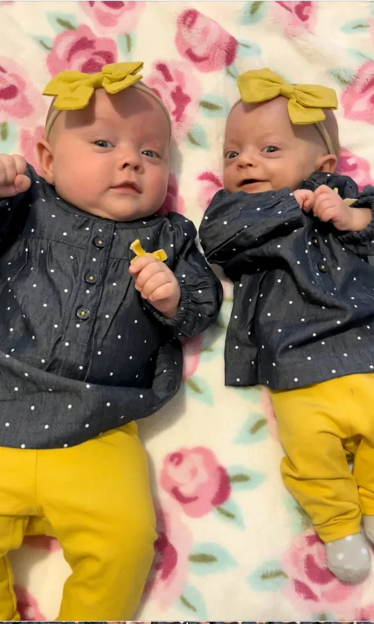 A petite baby, only one-third the size of her twin sister, demonstrates ...